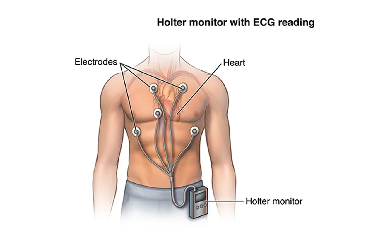 24 Hours Holter Monitoring